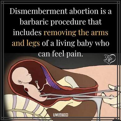 Dismemberment Abortion